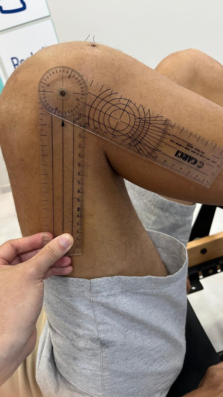 TRATAMENTO PÓS CIRÚRGICO
