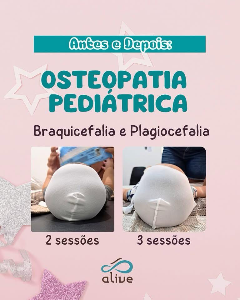 Osteopatia Pediatrica