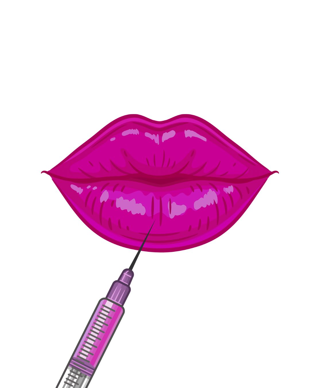 Preenchimento Labial