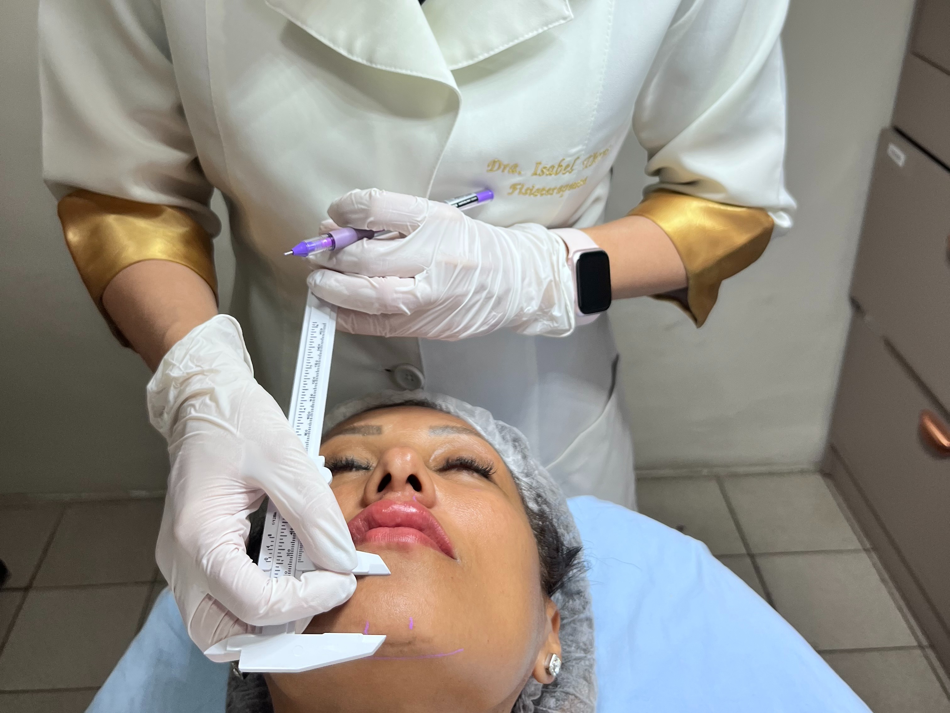 Harmonização Facial