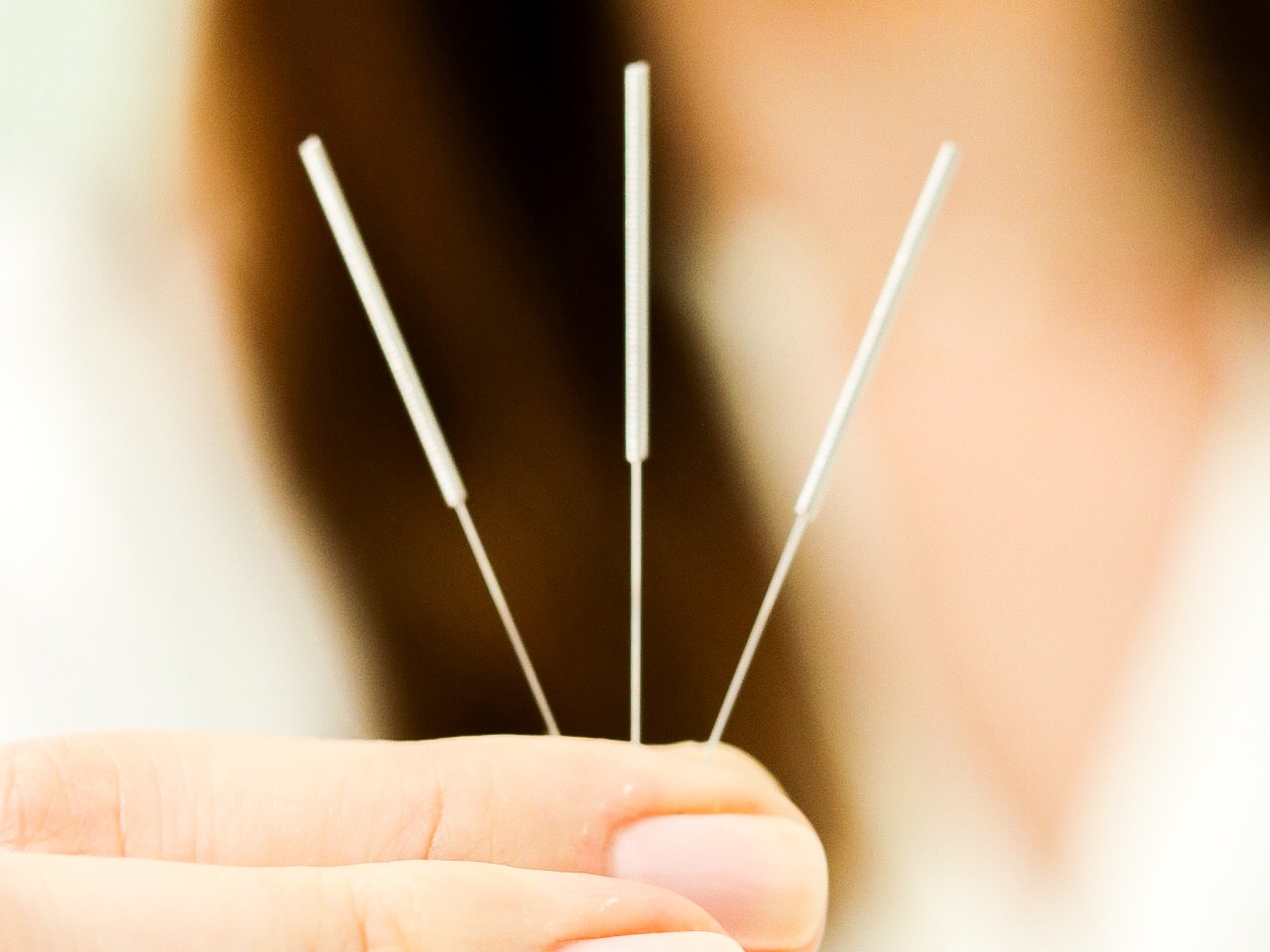 Acupuntura