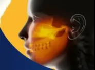 Fisioterapia nas DTM e Cefaléia