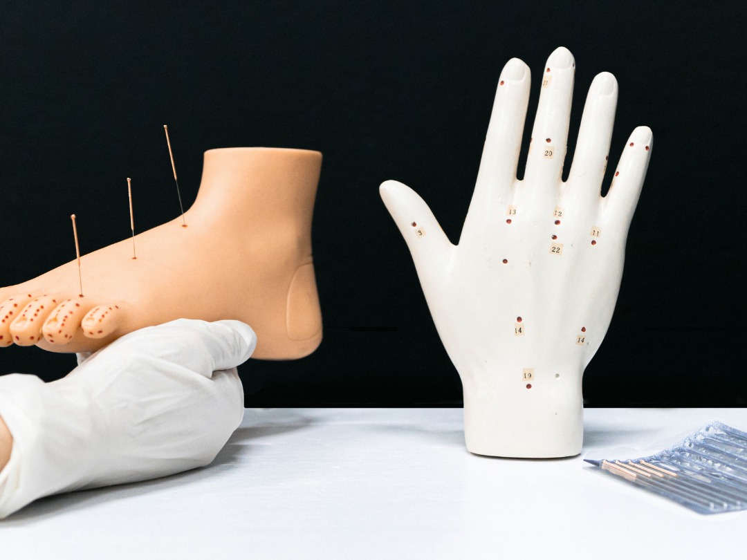 Acupuntura e Medicina Chinesa